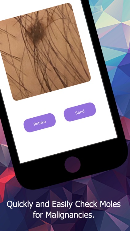 HealthAI - Skin Cancer