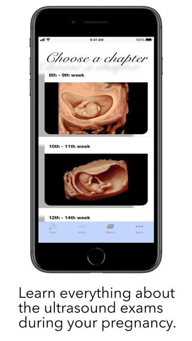 ScanBaby learn baby ultrasound Screenshot