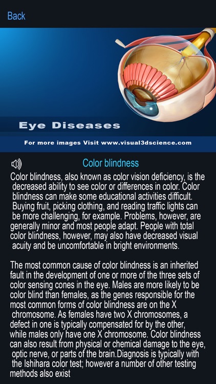 My Eye Anatomy screenshot-7