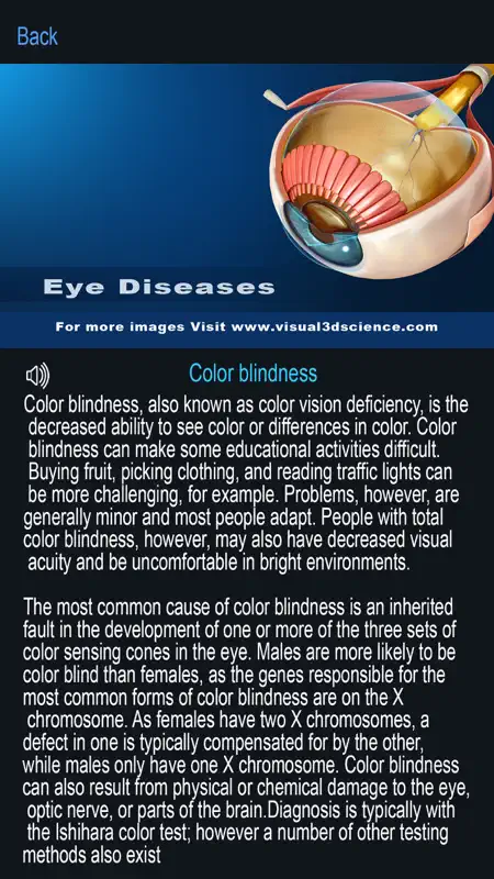 My Eye Anatomy screenshot 8 of 8
