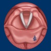 Vocal Folds ID