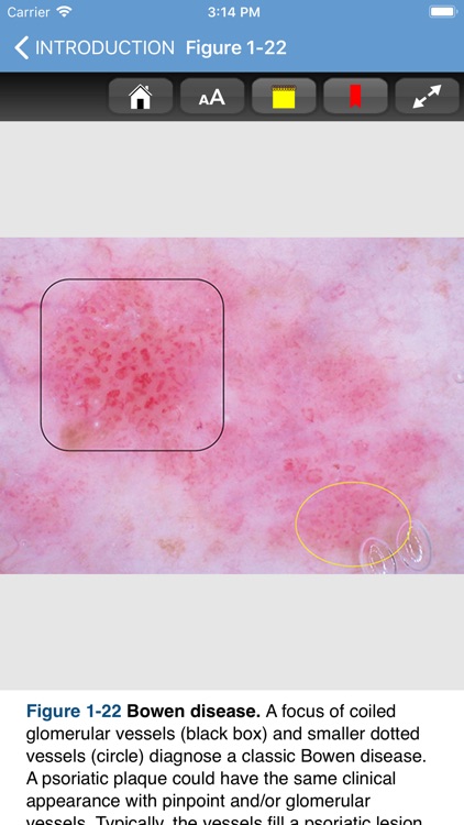 Dermoscopy Criteria Review screenshot-6