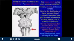 Neuroanatomy - SecondLook iPhone image 4