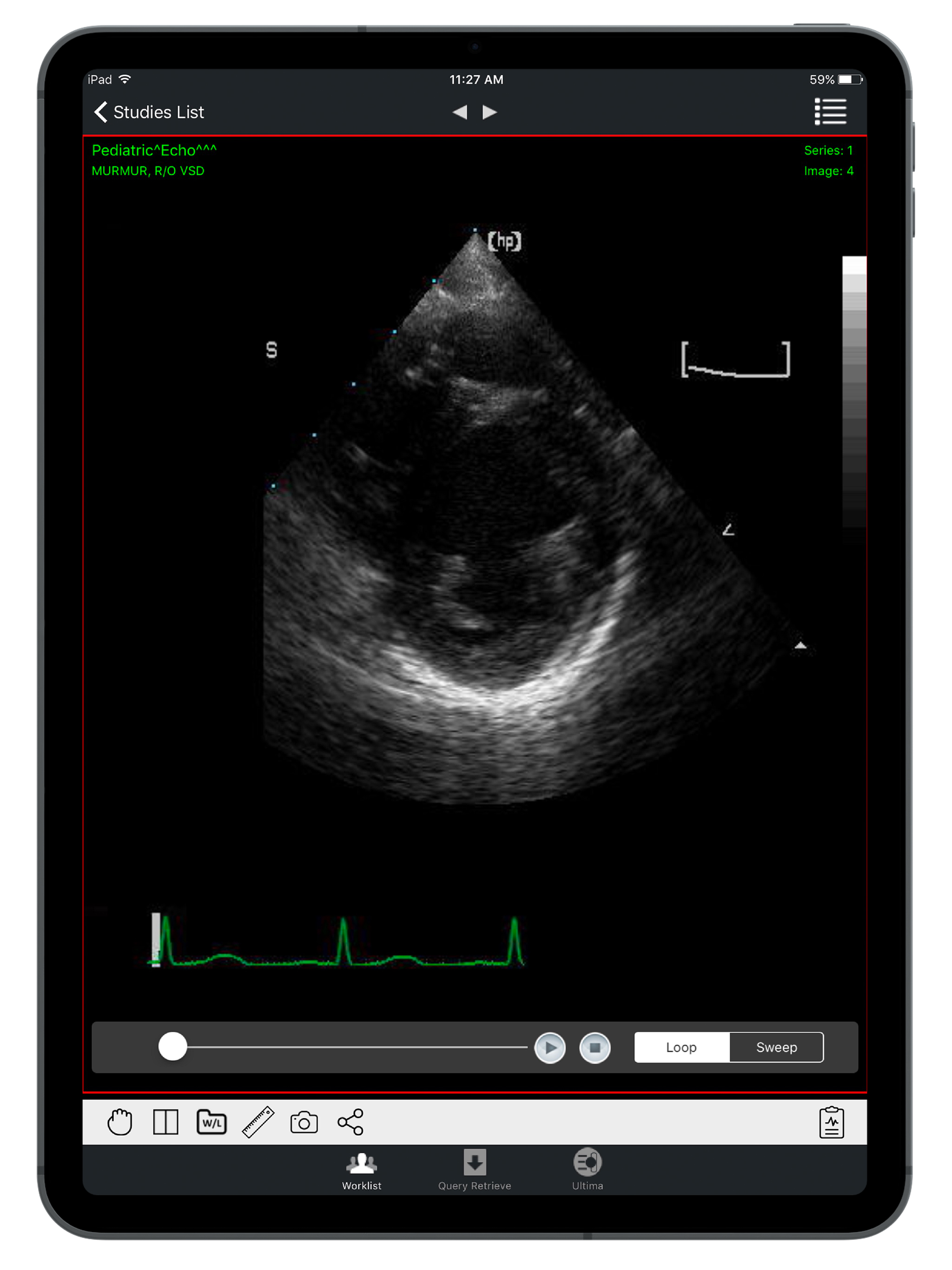 iPaxera screenshot 6