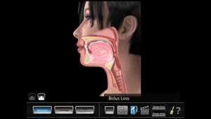 Oral Disorders screenshot 4