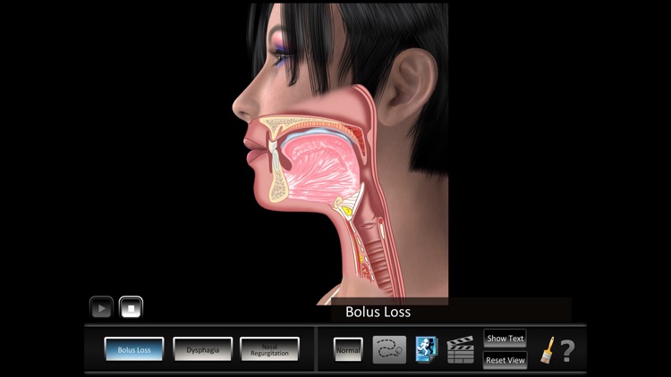Oral Disorders screenshot-3
