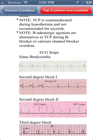 ACLS Fastのおすすめ画像3