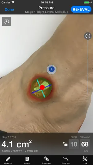 Swift Skin and Wound screenshot 3