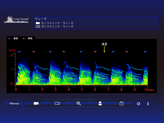 肺の聴診トレーニング - 見える肺音のおすすめ画像2