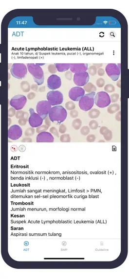 Game screenshot Microscopic Haematology apk