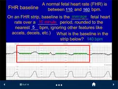 Fetal Heart Rate - SecondLook iPad image 3