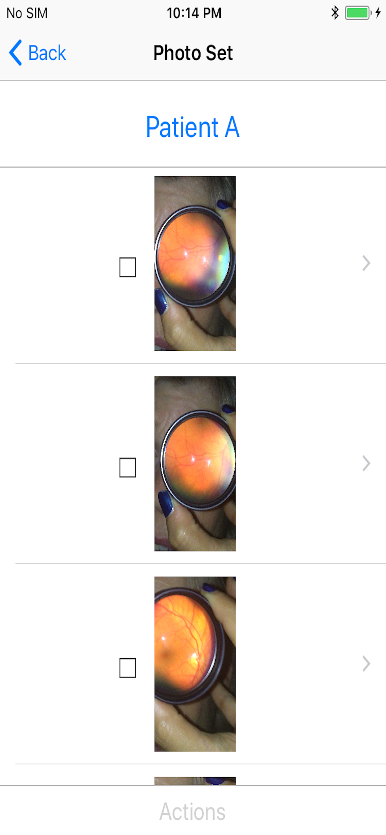 EyeTakes
