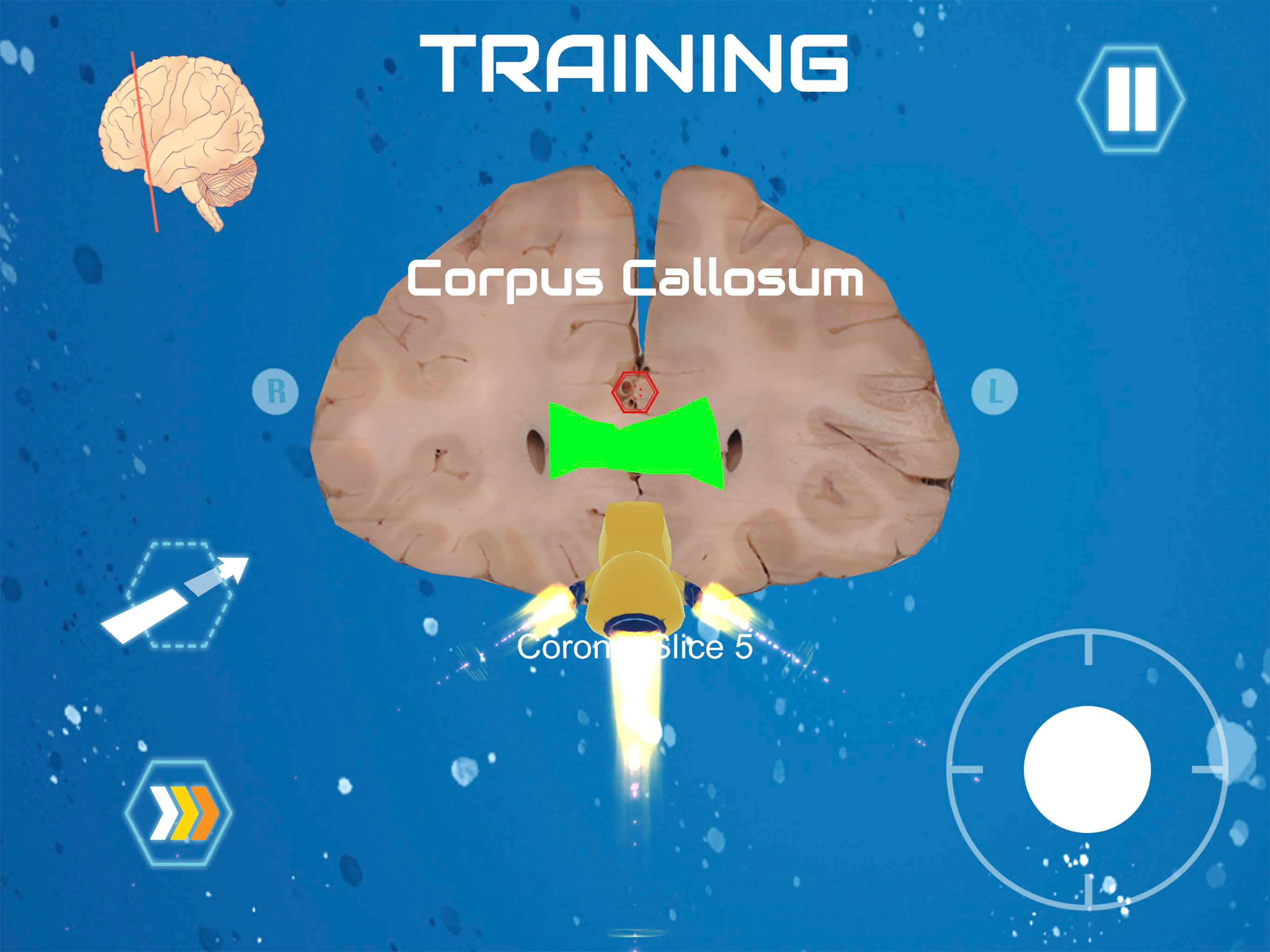 Cerebro the Virtual Lab screenshot 9