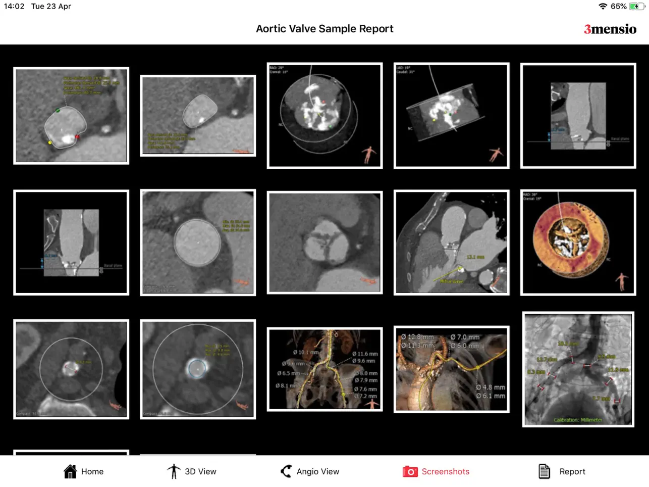 Screenshot #5 pour 3mensio Report