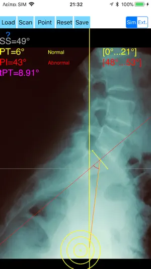 SpinopelvicBalanceApp screenshot 2