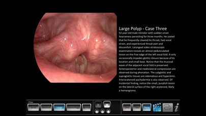Screenshot #2 pour Vocal Pathology: Polyps