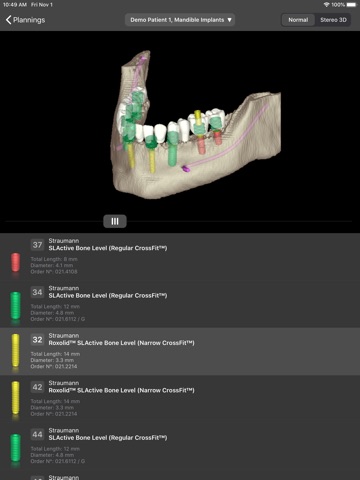 coDiagnostiX app screenshot 3