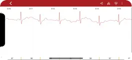 Game screenshot ECGo - ECG on the go hack