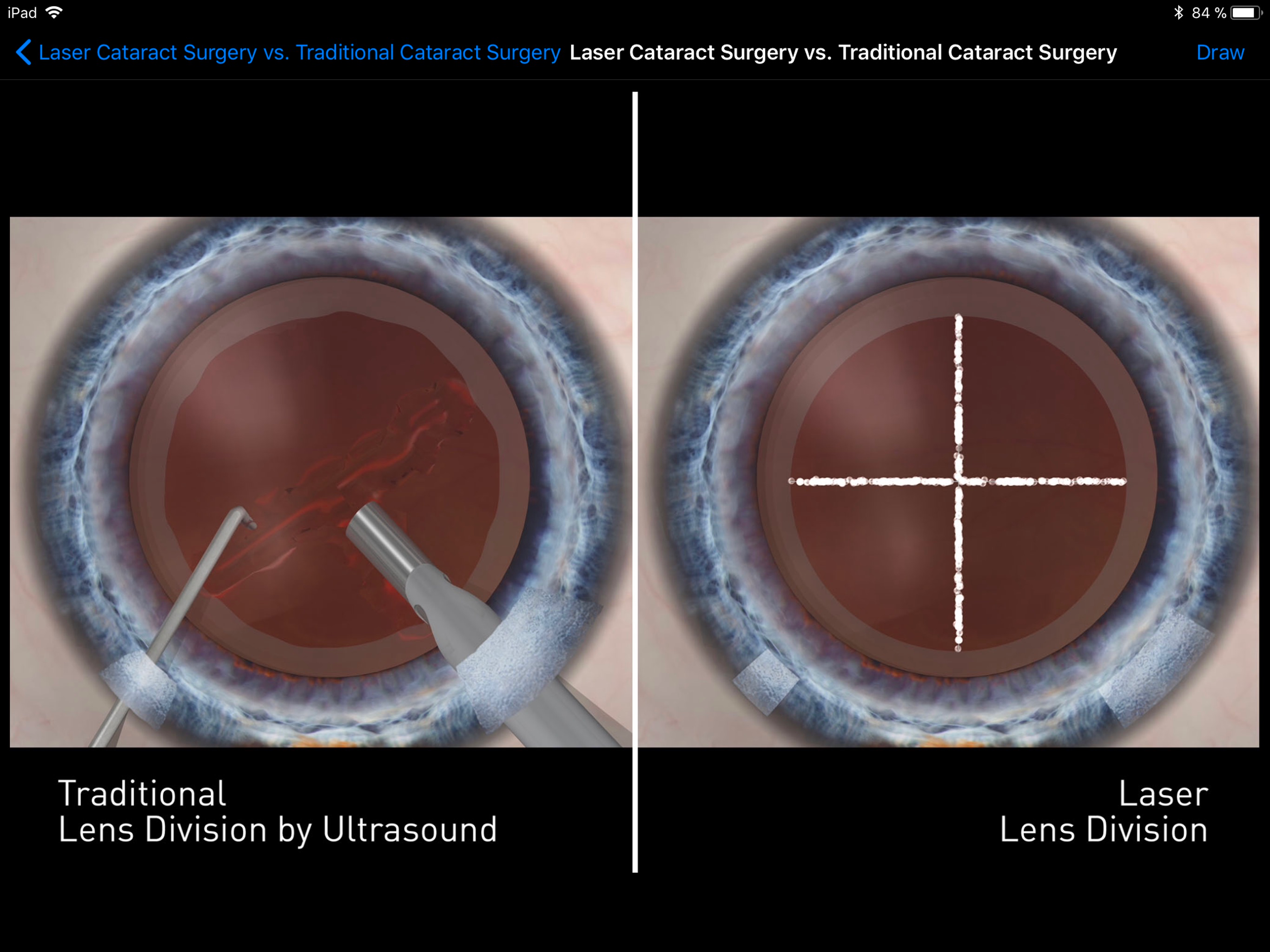 Sight Selector Subscription
