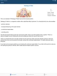 heart sounds auscultation ipad resimleri 3