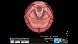 Game screenshot Vocal Folds ID mod apk