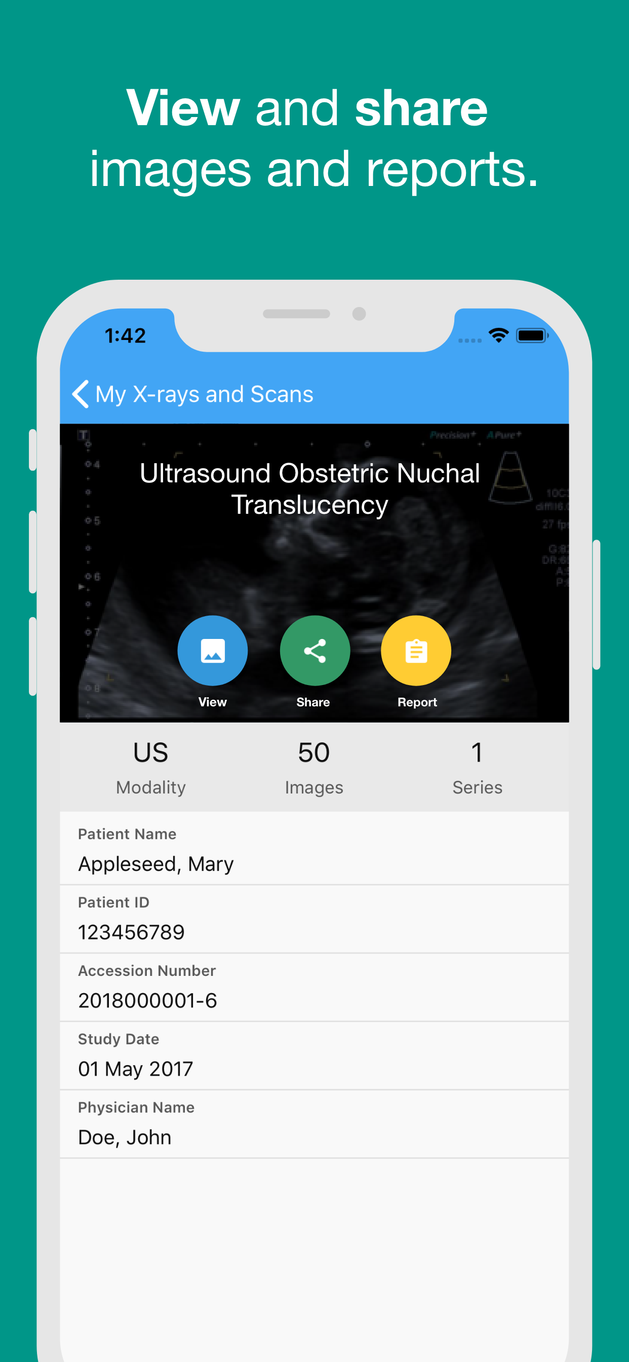 IRG Patient