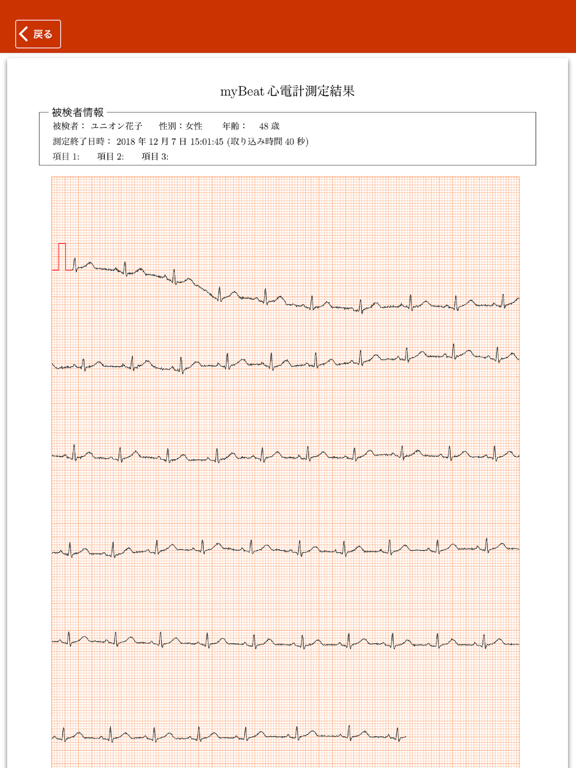 Screenshot #5 pour myBeat 心電計