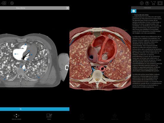 Fisiología & Patología App Store preview screenshot 19
