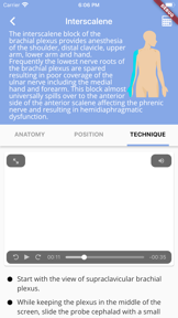 Regional Anesthesia Reference screenshot