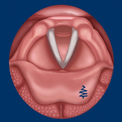 Vocal Folds ID