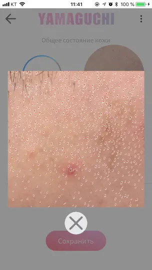Скриншот Yamaguchi Skin Test на iPhone 6
