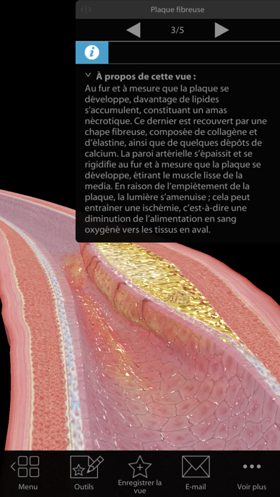 Screenshot #2 pour Physiologie & Pathologie