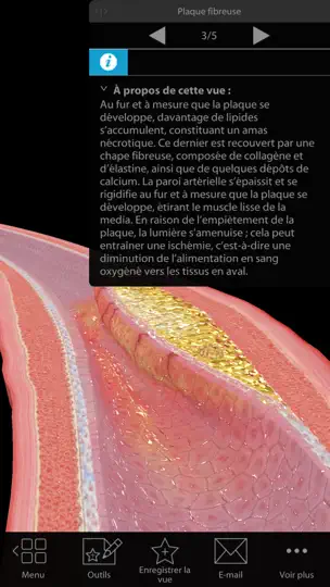 Capture d'écran de Physiologie & Pathologie sur iPhone 2
