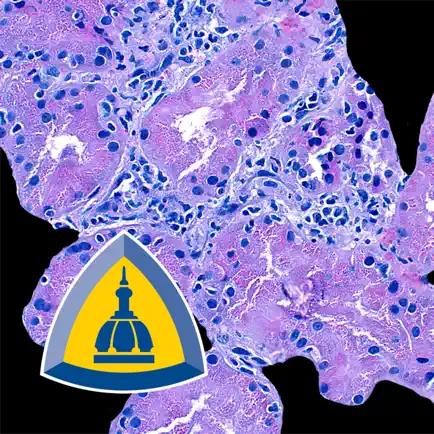 Renal Transplant Pathology Cheats