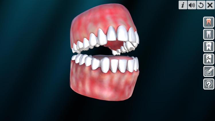 Incredible Human Teeth