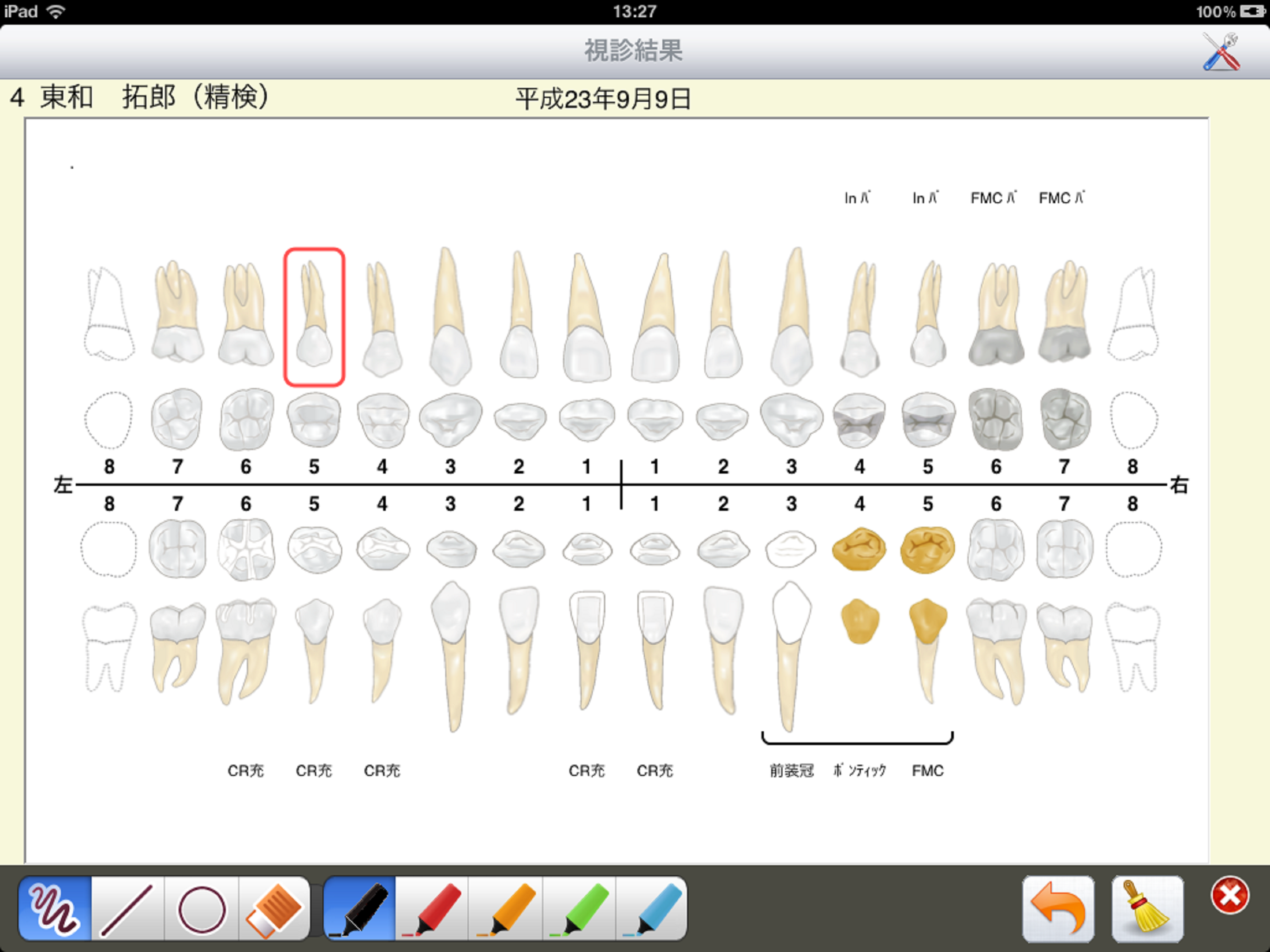 i-DS検査 screenshot 4