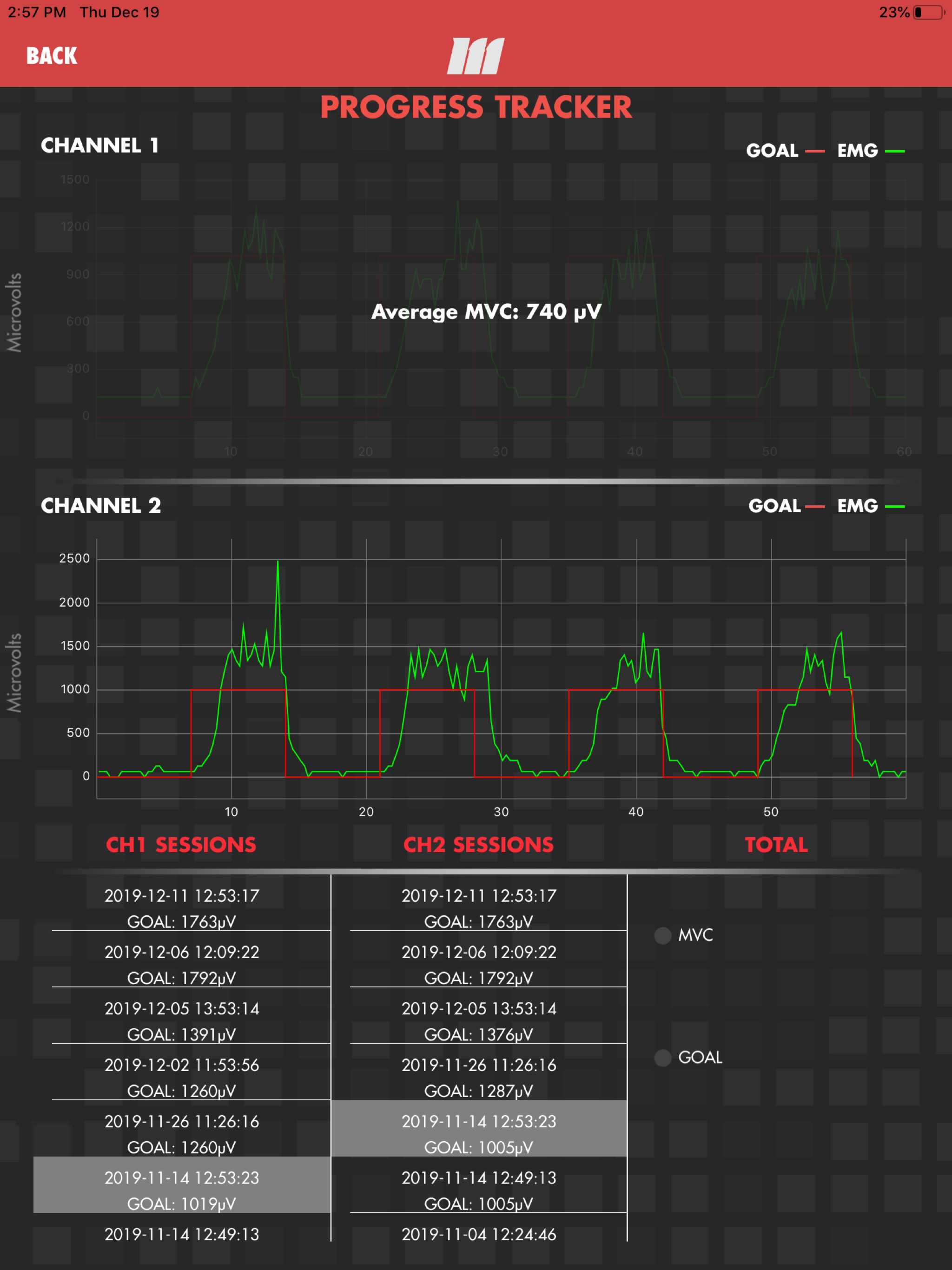 mTrigger™ Biofeedback