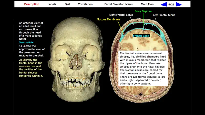 Human Skeleton: Gross Anatomy screenshot 1 of 10