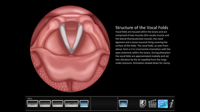 Vocal Pathology: Reflux Screenshot