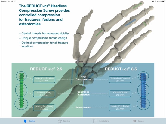 Screenshot #4 pour Skeletal Dynamics