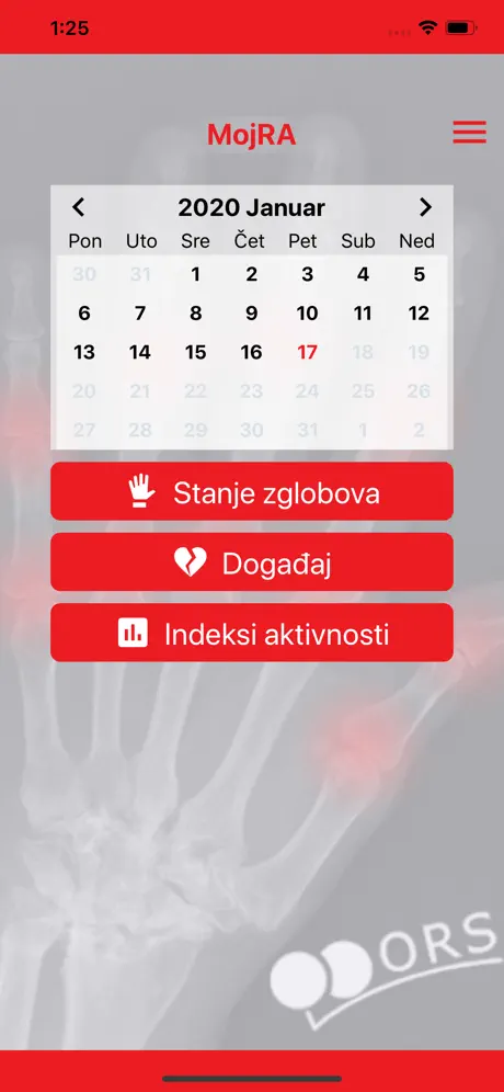 MojRA