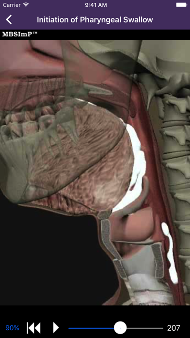 Dysphagia Screenshot