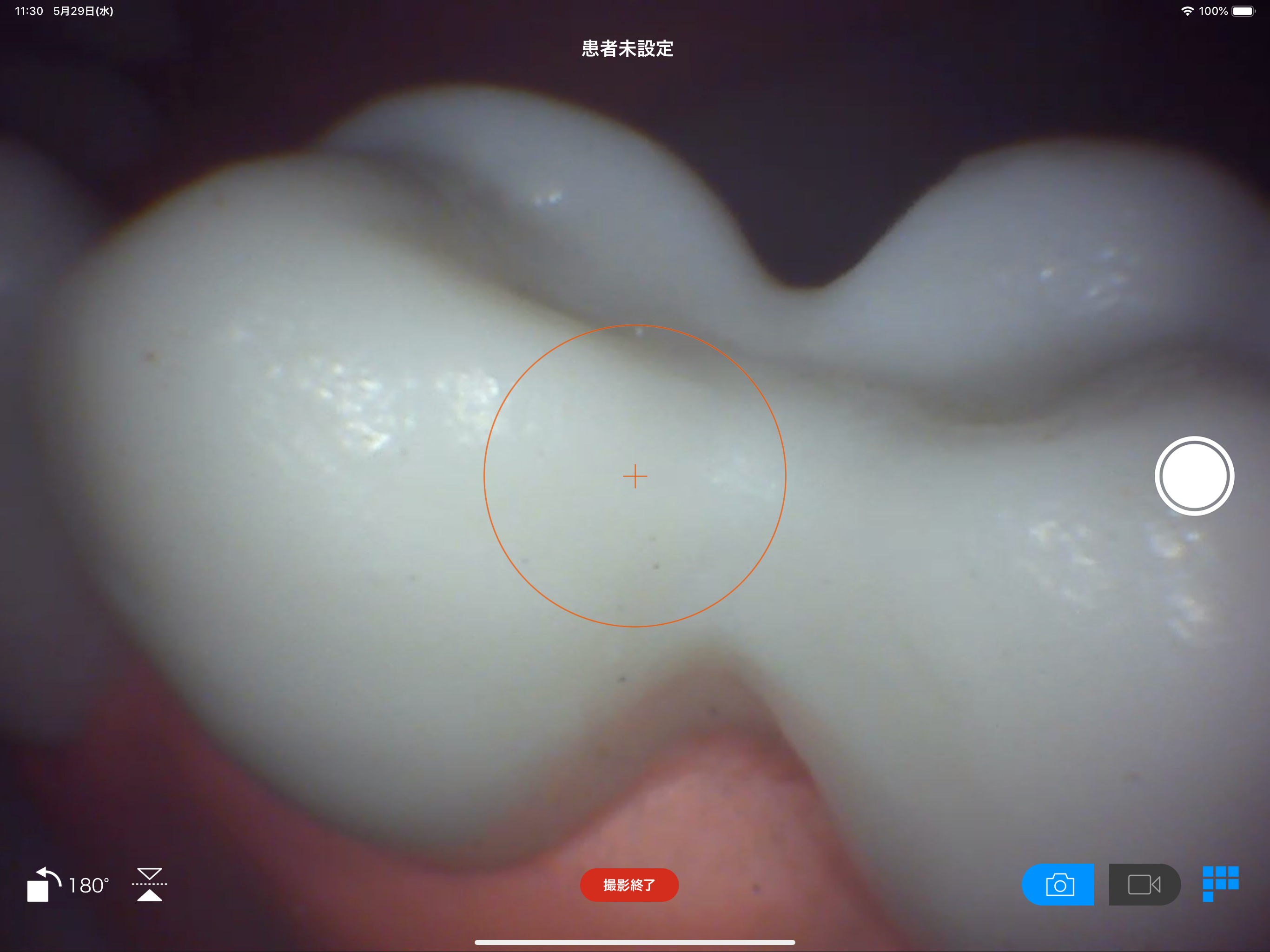 DentalShot screenshot 3
