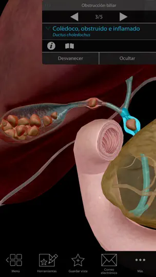 Captura de pantalla de Fisiología & Patología en iPhone 5