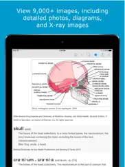 nursing dictionary by farlex ipad resimleri 3