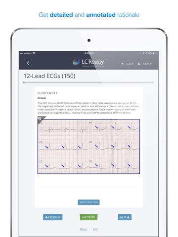 12 Lead ECG Challengeのおすすめ画像4