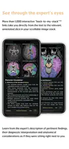 Radiology - Imaging in Stroke screenshot #5 for iPhone