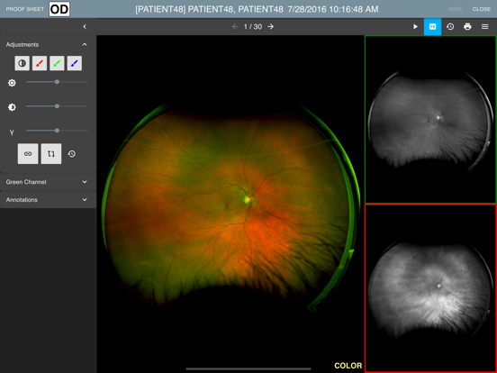 Screenshot #5 pour ContinuumPACS