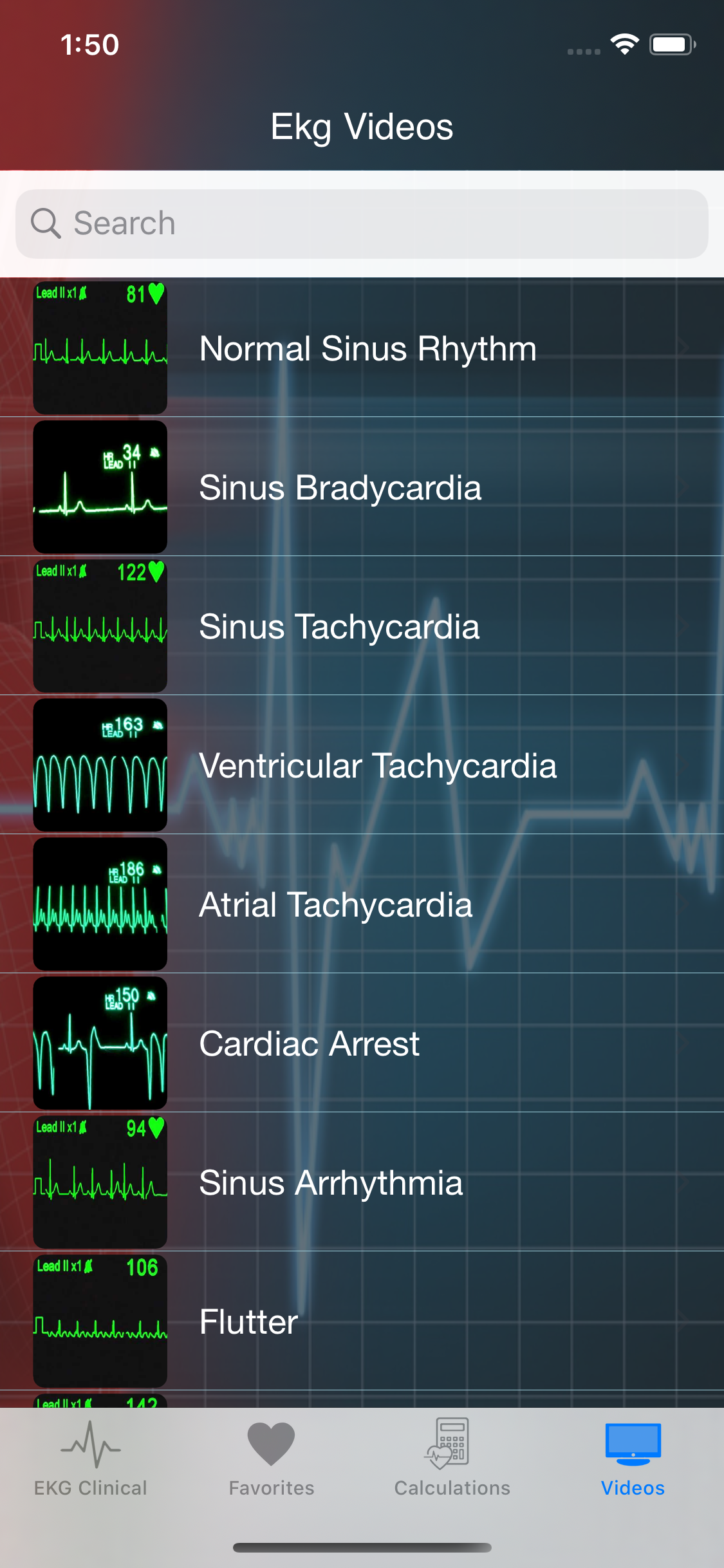 EKG Clinical