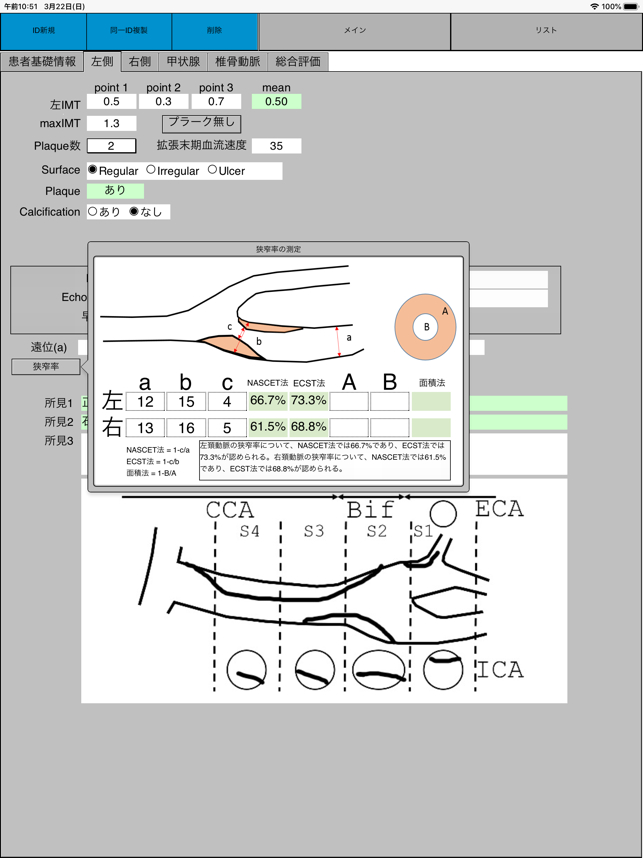 US-carotid(圖4)-速報App